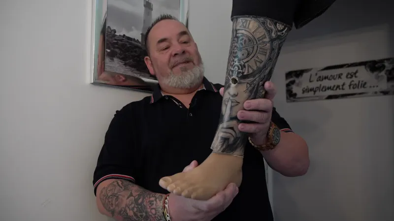 La prothèse personnalisée d'Emmanuel.